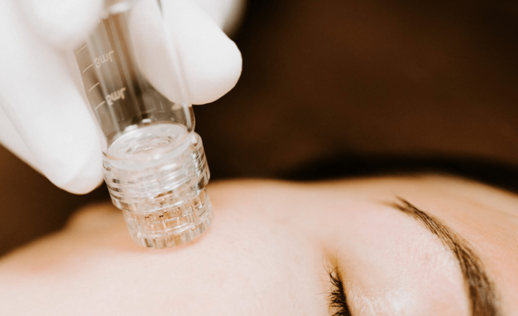 Micro-channeling micro-needling