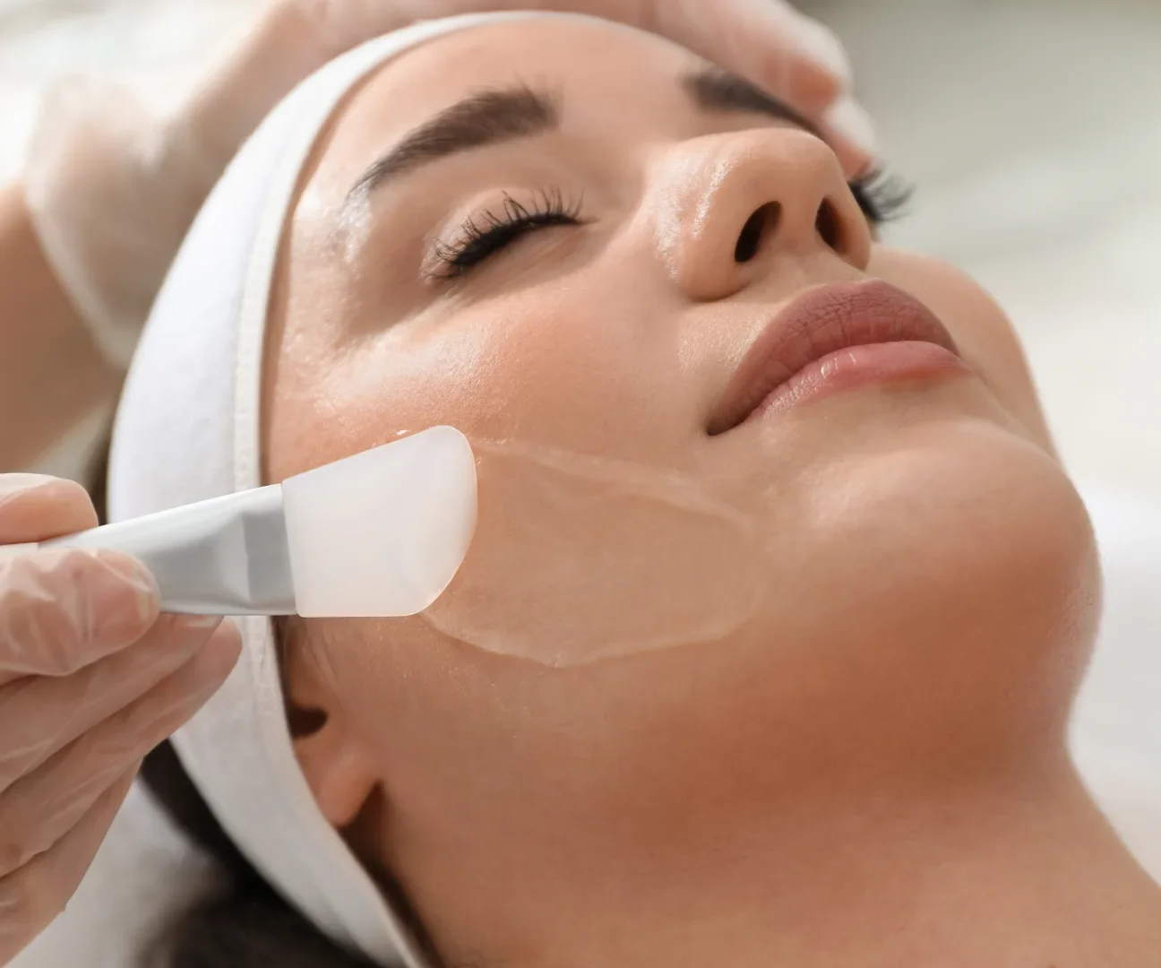 Chemical Peel 2